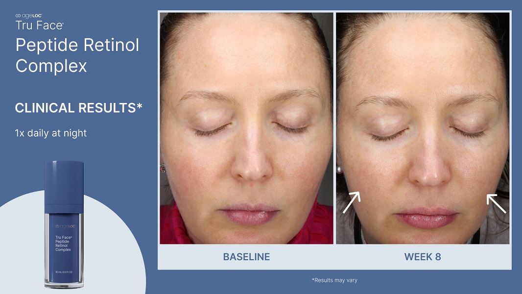 ageLOC Tru Face Peptide Retinol Complex Vorher Nachher Augenpartie