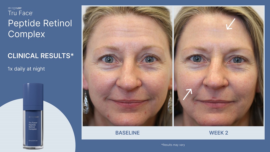 ageLOC Tru Face Peptide Retinol Complex Vorher Nachher klinische Ergebnisse